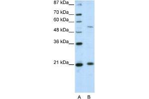 WB Suggested Anti-ZNF31 Antibody Titration:  2. (ZSCAN20 Antikörper  (N-Term))