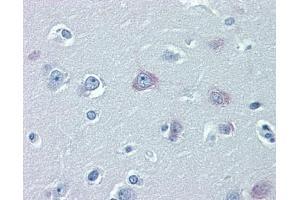 TRPM2 antibody was used for immunohistochemistry at a concentration of 4-8 ug/ml. (TRPM2 Antikörper  (N-Term))