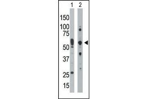 The anti-PRKR Pab (ABIN392779 and ABIN2837995) is used in Western blot to detect PRKR in mouse uterus tissue lysate (Lane 1) and HepG2 cell lysate (Lane 2). (EIF2AK2 Antikörper  (C-Term))