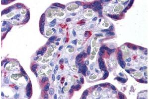 Human Placenta: Formalin-Fixed, Paraffin-Embedded (FFPE) (NLRC3 Antikörper  (Internal Region))