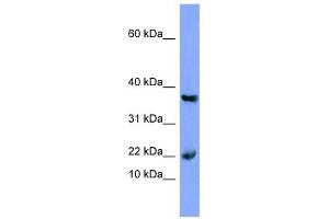 Myoglobin antibody used at 1 ug/ml to detect target protein. (Myoglobin Antikörper  (N-Term))
