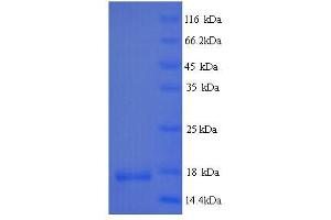 SDS-PAGE (SDS) image for Interleukin 4 (IL4) (AA 25-153) protein (His tag) (ABIN5713560)