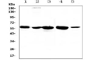 Western blot analysis of ETV6/Tel using anti-ETV6/Tel antibody (ABIN5693220).