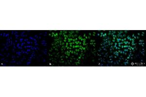 Immunofluorescence (fixed cells) (IF/ICC) image for anti-Tumor Necrosis Factor Receptor Superfamily, Member 1A (TNFRSF1A) (AA 20-43) antibody (PE) (ABIN2482042)