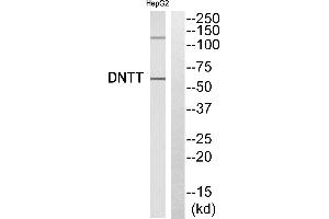 Western blot analysis of extracts from HepG2 cells, using DNTT antibody. (TdT Antikörper)