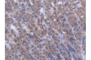 DAB staining on IHC-P; Samples: Rat Stomach Tissue (GCK Antikörper  (AA 194-410))