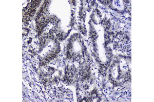 Immunohistochemistry (IHC) image for anti-Splicing Factor 1 (SF1) (AA 160-266) antibody (ABIN5692946)