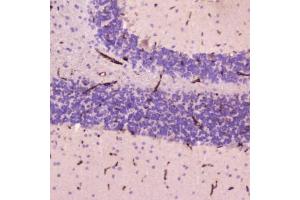 IHC testing of FFPE human cerebellum tissue with C-Reactive Protein antibody at 2ug/ml. (CRP Antikörper  (AA 20-230))