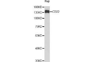 Western blot analysis of extracts of Raji cells, using CD22 Antibody. (CD22 Antikörper)