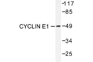 Image no. 1 for anti-Cyclin E1 (CCNE1) antibody (ABIN265380) (Cyclin E1 Antikörper)