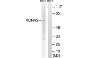 Western blot analysis of extracts from MCF-7 cells, using KCNV2 Antibody. (KCNV2 Antikörper  (AA 187-236))