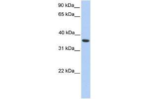 WB Suggested Anti-MAGEA4 Antibody Titration: 0. (MAGEA4 Antikörper  (C-Term))