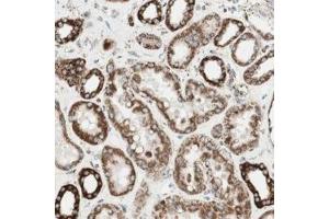 Immunohistochemical staining of human kidney with TOMM22 polyclonal antibody  shows strong cytoplasmic positivity in renal tubules at 1:200-1:500 dilution. (TOMM22 Antikörper)