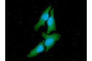 ICC/IF analysis of CSK in HeLa cells line, stained with DAPI (Blue) for nucleus staining and monoclonal anti-human CSK antibody (1:100) with goat anti-mouse IgG-Alexa fluor 488 conjugate (Green) (CSK Antikörper  (AA 1-450))