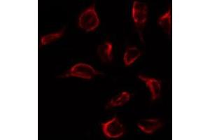 ABIN6267275 staining 293 by IF/ICC. (Estrogen Receptor alpha Antikörper  (pTyr537))
