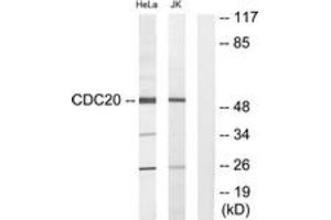 Western blot analysis of extracts from Jurkat/HeLa cells, using p55CDC Antibody. (CDC20 Antikörper  (AA 81-130))