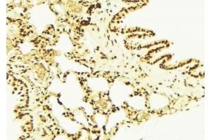 ABIN6277732 at 1/100 staining Mouse lung tissue by IHC-P. (NRF2 Antikörper  (pSer40))