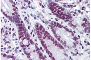 Human Small Intestine: Formalin-Fixed, Paraffin-Embedded (FFPE) (HDAC1 Antikörper  (AA 1-483))