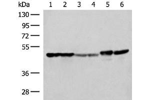 Western blot analysis of Hela A375 Human fetal liver tissue Human fetal brain tissue HepG2 cell and Mouse brain tissue lysates using FLOT2 Polyclonal Antibody at dilution of 1:350 (Flotillin 2 Antikörper)