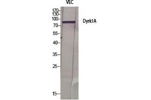 Western Blot analysis of various cells using Dyrk1A Polyclonal Antibody diluted at 1:500. (DYRK1A Antikörper  (AA 40-120))