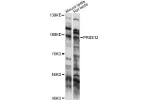 Western blot analysis of extracts of various cell lines, using PRSS12 antibody (ABIN6292705) at 1:1000 dilution.