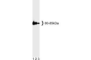 Western Blotting (WB) image for anti-MutL Homolog 1 (MLH1) antibody (ABIN967315) (MLH1 Antikörper)