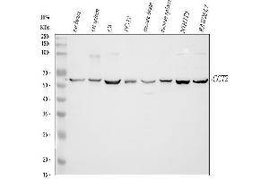 Western blot analysis of CCT2 using anti-CCT2 antibody (ABIN4886512). (CCT2 Antikörper  (AA 414-535))