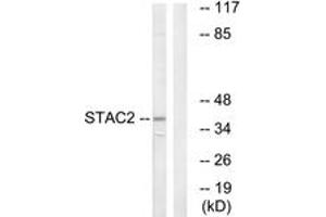 Western blot analysis of extracts from K562 cells, using STAC2 Antibody. (STAC2 Antikörper  (AA 211-260))