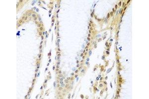 Immunohistochemistry of paraffin-embedded Human stomach using MYBBP1A Polyclonal Antibody at dilution of 1:100 (40x lens).