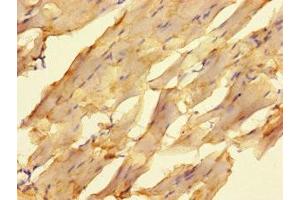 Immunohistochemistry of paraffin-embedded human skeletal muscle tissue using ABIN7176667 at dilution of 1:100 (ELAC1 Antikörper  (AA 1-363))