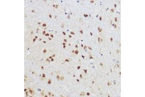 Immunohistochemistry of paraffin-embedded mouse brain using KLF12 antibody (ABIN7268152) at dilution of 1:100 (40x lens).