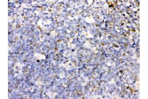 CD27 was detected in paraffin-embedded sections of human tonsil tissues using rabbit anti- CD27 Antigen Affinity purified polyclonal antibody (Catalog # ) at 1 µg/mL. (CD27 Antikörper  (AA 20-191))