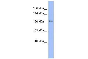 WB Suggested Anti-PI4KB Antibody Titration: 0. (PI4KB Antikörper  (N-Term))