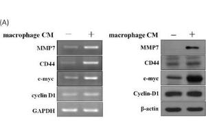 Western Blotting (WB) image for anti-Myc Proto-Oncogene protein (MYC) (Center) antibody (ABIN2855631)
