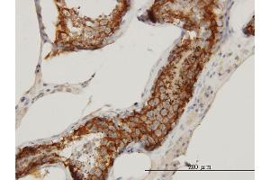 Immunoperoxidase of monoclonal antibody to FATE1 on formalin-fixed paraffin-embedded human testis. (FATE1 Antikörper  (AA 2-100))