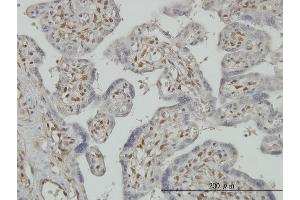 Immunostaining (ISt) image for anti-3'-phosphoadenosine 5'-phosphosulfate Synthase 2 (PAPSS2) (AA 513-612) antibody (ABIN563924)