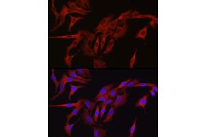 Immunofluorescence analysis of A-549 cells using TMPRSS2 Rabbit pAb (ABIN6132728, ABIN6149286, ABIN6149287 and ABIN6219138) at dilution of 1:50 (40x lens). (TMPRSS2 Antikörper  (AA 140-400))