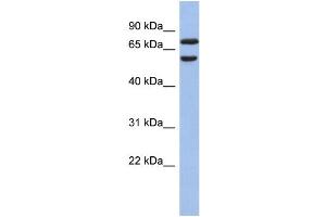 WB Suggested Anti-GNL3L Antibody Titration: 0. (GNL3L Antikörper  (N-Term))