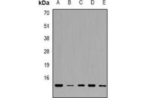 Western blot analysis of TRP14 expression in HL60 (A), Raji (B), K562 (C), SW480 (D), A549 (E) whole cell lysates. (TXNDC17 Antikörper)