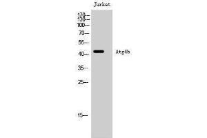 Western Blotting (WB) image for anti-Autophagy related 4B Cysteine Peptidase (ATG4B) (Internal Region) antibody (ABIN3183424) (ATG4B Antikörper  (Internal Region))