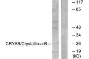 Western blot analysis of extracts from K562 cells, treated with Ca2+ 40nM 30', using CRYAB (Ab-59) Antibody.