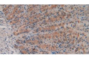 Detection of MMP3 in Rat Stomach Tissue using Polyclonal Antibody to Matrix Metalloproteinase 3 (MMP3) (MMP3 Antikörper  (AA 278-450))