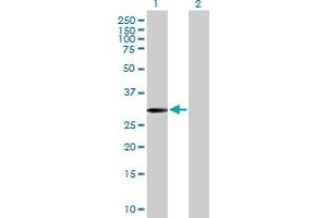 Western Blot analysis of SLC22A24 expression in transfected 293T cell line by SLC22A24 MaxPab polyclonal antibody. (SLC22A24 Antikörper  (AA 1-322))