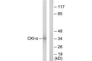 Western Blotting (WB) image for anti-Casein Kinase 1, alpha 1 (CSNK1A1) (Internal Region) antibody (ABIN6299683) (CSNK1A1 Antikörper  (Internal Region))