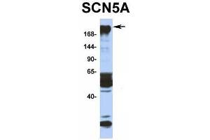 Host:  Rabbit  Target Name:  SCN5A  Sample Type:  Human Fetal Muscle  Antibody Dilution:  1. (SCN5A Antikörper  (N-Term))