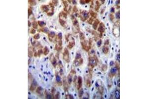 Immunohistochemistry analysis in formalin fixed and paraffin embedded human liver tissue reacted with GOG8A Antibody (N-term) followed by peroxidase conjugation of the secondary antibody and DAB staining.
