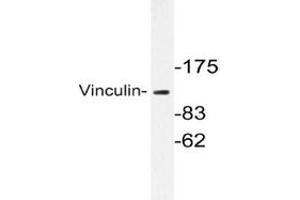 Image no. 1 for anti-Vinculin (VCL) antibody (ABIN272104) (Vinculin Antikörper)
