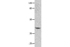 Western blot analysis of Human leiomyosarcoma tissue, using GNA11 Polyclonal Antibody at dilution of 1:450 (GNA11 Antikörper)