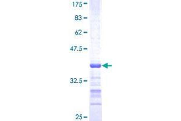 SH3RF2 Protein (AA 640-729) (GST tag)