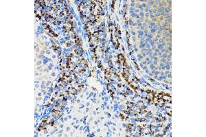 Immunohistochemistry of paraffin-embedded rat ovary using SRP19 antibody (ABIN2560139) at dilution of 1:100 (40x lens). (SRP19 Antikörper)